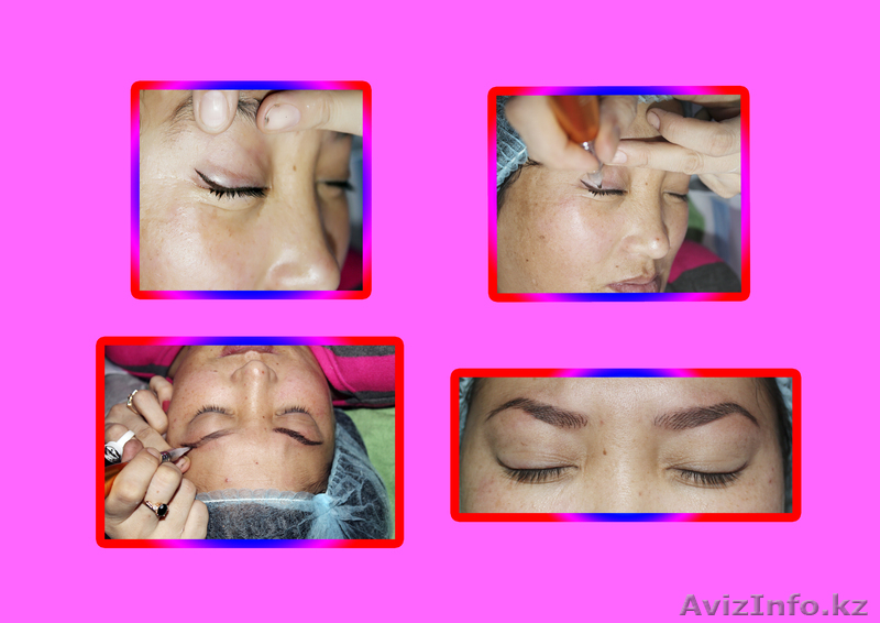 косметология и китайский точечный массаж   - Изображение #3, Объявление #55399