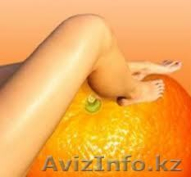 Худеем за 2 недели, антицеллюлитный, вакуумный и лечебный массаж - Изображение #3, Объявление #919047