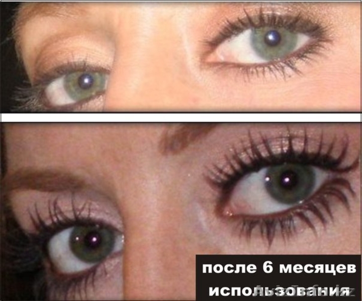 lurey lash md средство для роста ресниц и бровей. - Изображение #4, Объявление #924845