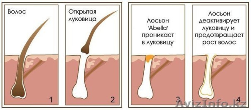 Лосьон “Abella” избавит Вас от нежелательных волос на лице и теле. - Изображение #2, Объявление #946223