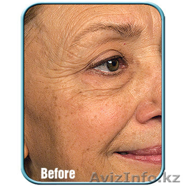 Крем StemCellTherapy - Изображение #5, Объявление #950125