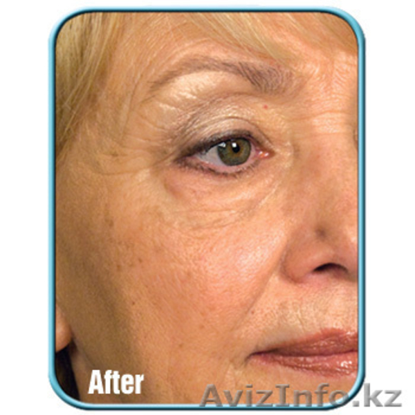 Крем StemCellTherapy - Изображение #4, Объявление #950125