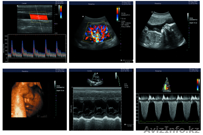 Портативный цветной 3D Допплер ультразвуковой аппарат (УЗИ) С7 - Изображение #4, Объявление #1126278