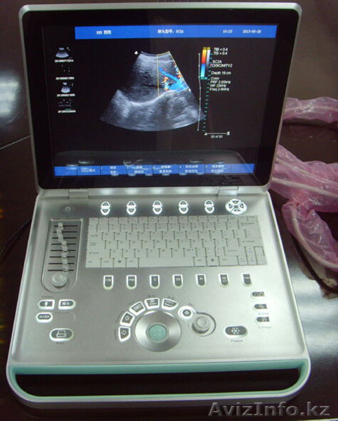 Портативный цветной 3D Допплер ультразвуковой аппарат (УЗИ) С7 - Изображение #1, Объявление #1126278