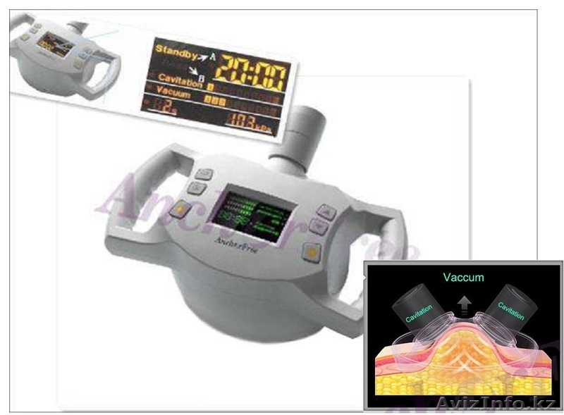 Вакуумный аппарат для похудения, подтяжки кожи, удаления морщин - Изображение #1, Объявление #1126281