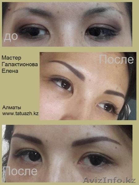 удаление некачественного татуажа - Изображение #4, Объявление #1131611