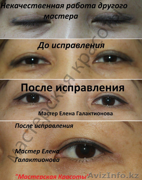 удаление некачественного татуажа - Изображение #3, Объявление #1131611