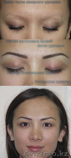 Исправление некачественного татуажа - Изображение #3, Объявление #1133530