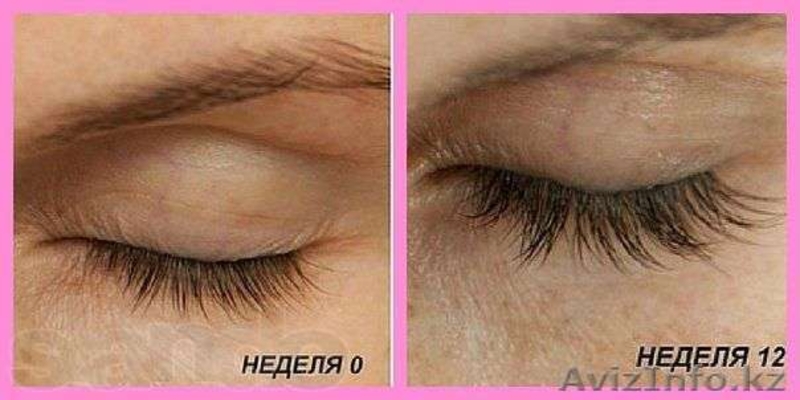 Сыворотка для наращивания ресниц Lurey Lash MD!!! - Изображение #1, Объявление #1144716