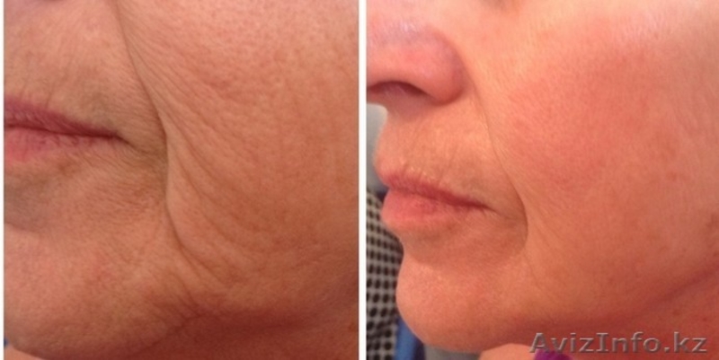 Омолаживающее ежедневное средство лаборатоии Щварц - Изображение #3, Объявление #1147138