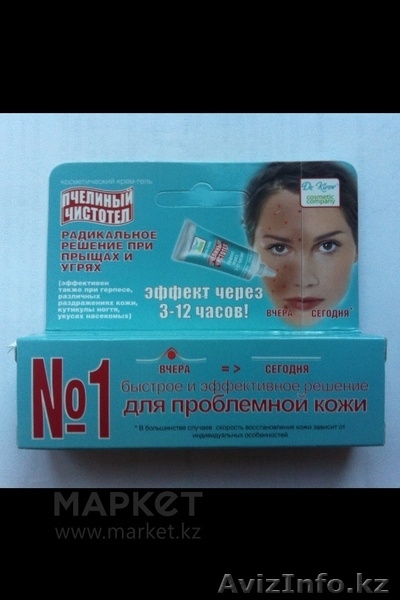 Эффективное лечение угревой сыпи, акне, герпеса, простудных прыщей. - Изображение #1, Объявление #1199633
