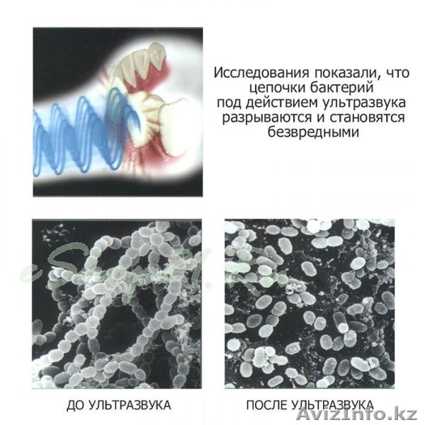 Ультразвуковая зубная щетка MEGASONEX - Изображение #6, Объявление #1251177