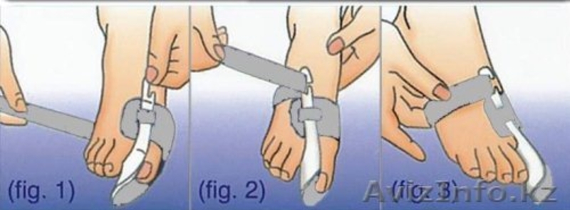Корректирующий бандаж Корректор на большой палец ноги ночной 14064 - Изображение #3, Объявление #1307001