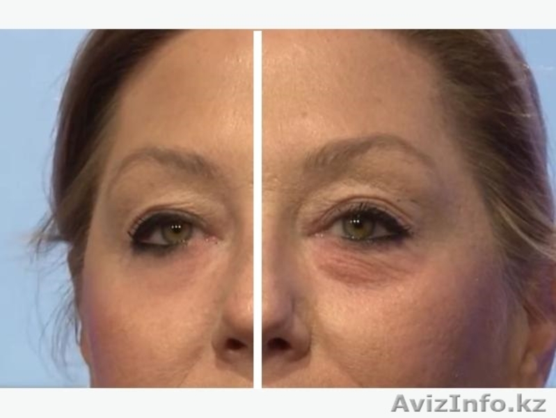 Крем против морщин Jeunesse Instantly Ageless ™ (sachets)  - Изображение #4, Объявление #1312500