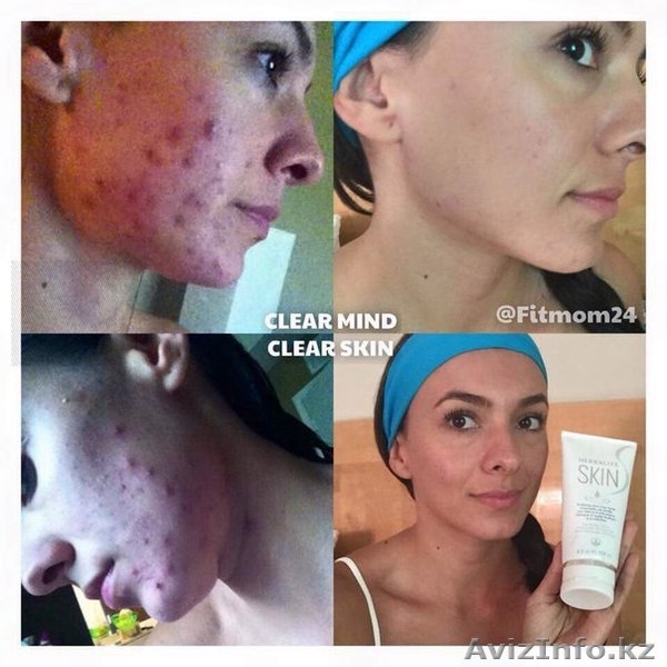 Косметика  Линия Herbalife SKIN - Изображение #1, Объявление #1325709