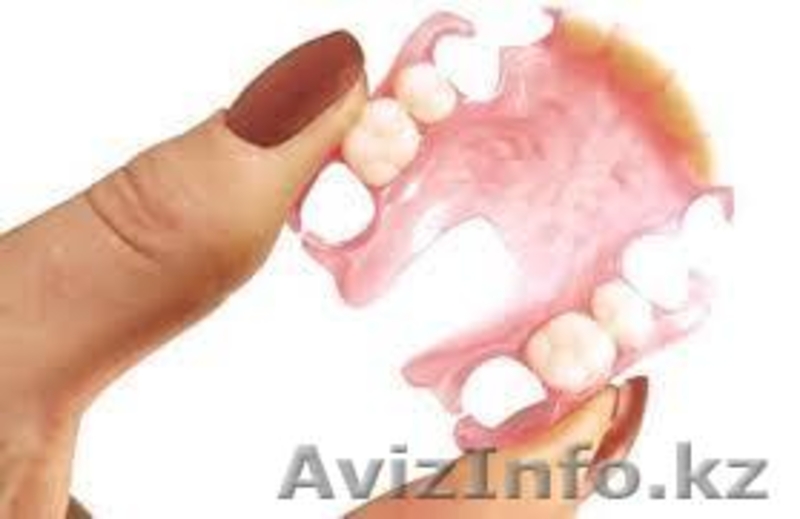 лечение кариеса , пломбирование зуба , протезирования зубов - Изображение #4, Объявление #1425764