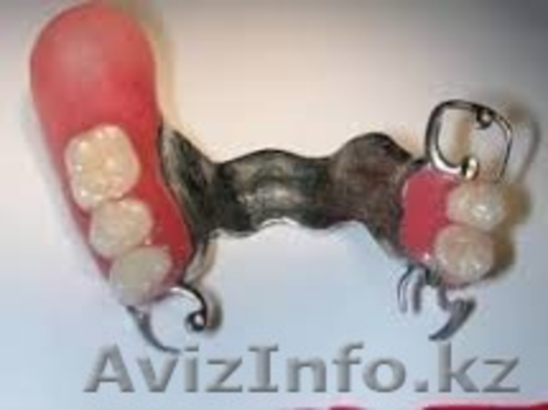 лечение кариеса , пломбирование зуба , протезирования зубов - Изображение #5, Объявление #1425764