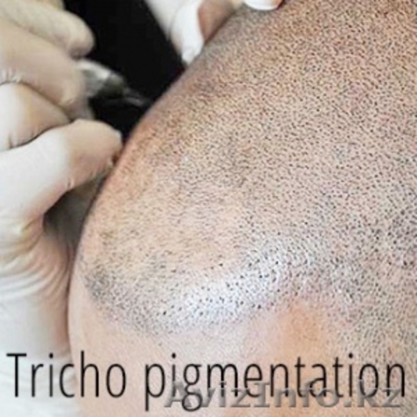 Трихопигментация в Казахстане  - Изображение #5, Объявление #1481932