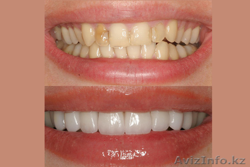 Стоматология                                                                     - Изображение #7, Объявление #1482898