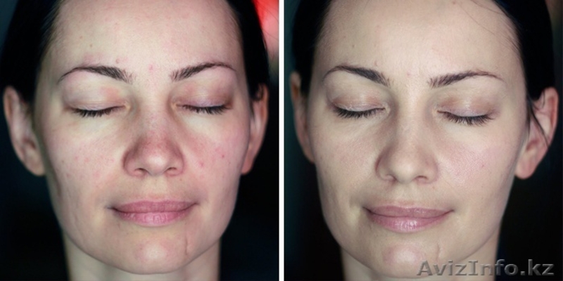 Врач-косметолог с высшим медицинским образованием - Изображение #3, Объявление #1487811