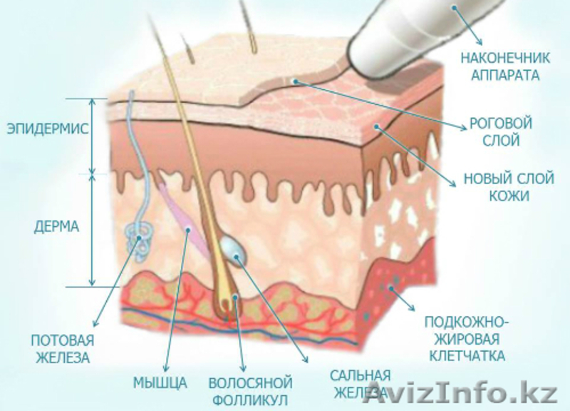 Врач-косметолог с высшим медицинским образованием-Махмудова Д. Тел: 87017831918  - Изображение #4, Объявление #1487808