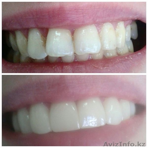 Люминиры качественно и профессионально - Изображение #1, Объявление #1559377