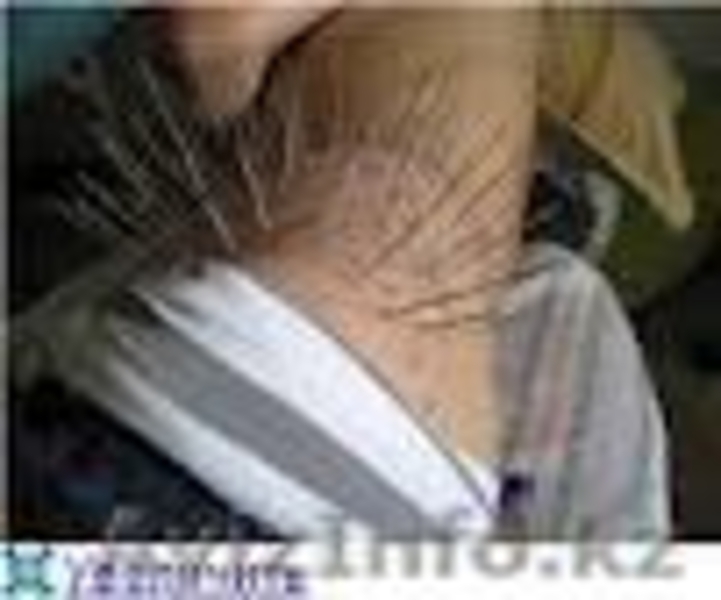 Иглотерапия в Алматы - Изображение #2, Объявление #1587800