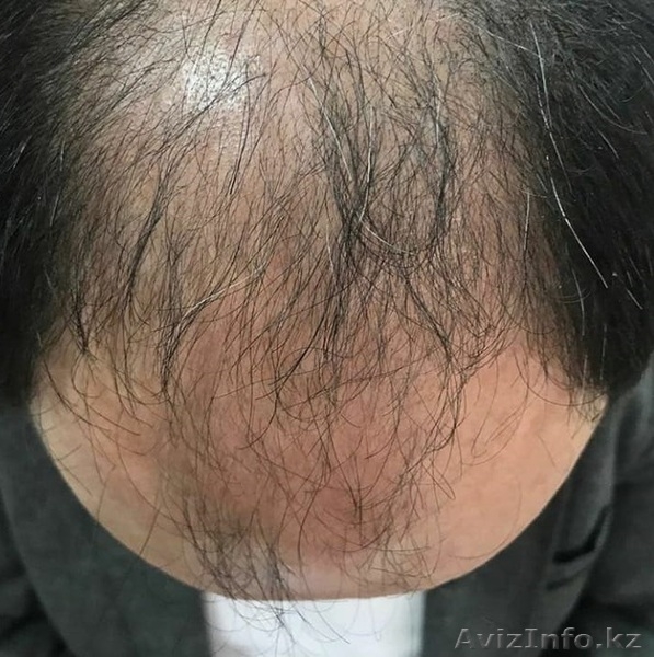  Чудо бальзам - Изображение #4, Объявление #1623657