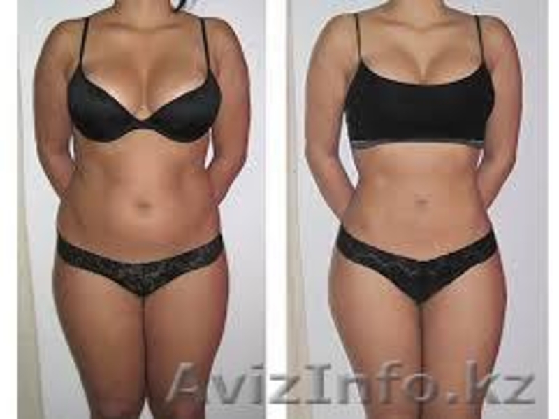 Коррекция фигуры в Алматы. - Изображение #3, Объявление #1630068