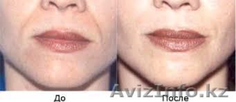 Коррекция фигуры в Алматы. - Изображение #5, Объявление #1630068