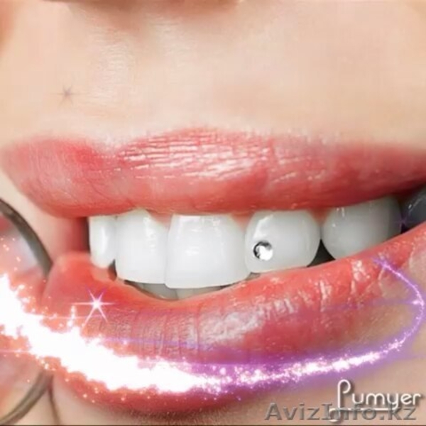 Стоматология Алматы круглосуточно! - Изображение #3, Объявление #1328322