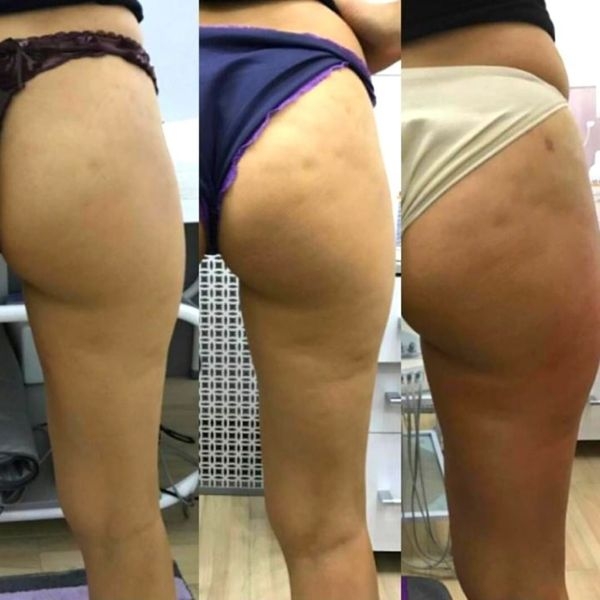 Аппаратная косметология для лица и тела - Изображение #3, Объявление #1646242