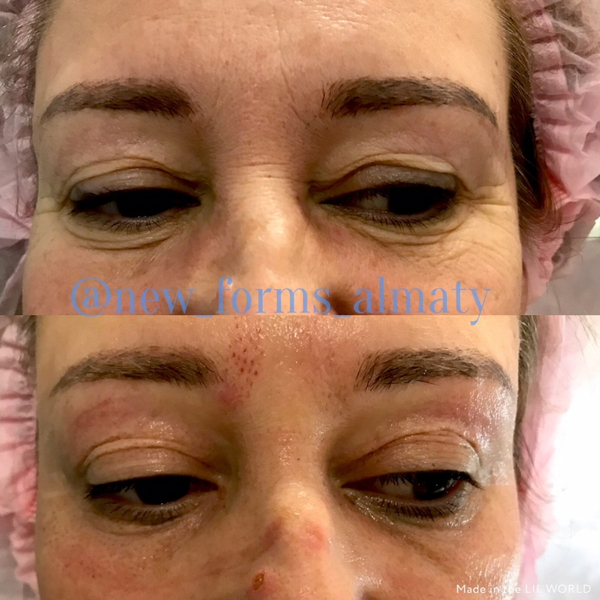 Аппаратная косметология для лица и тела - Изображение #5, Объявление #1646242