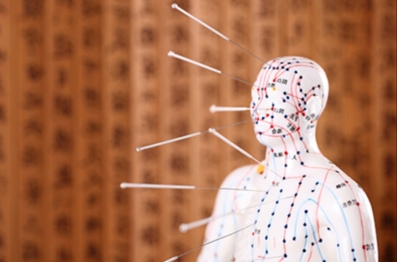 Иглорефлексотерапия в Алматы - Изображение #3, Объявление #1663653