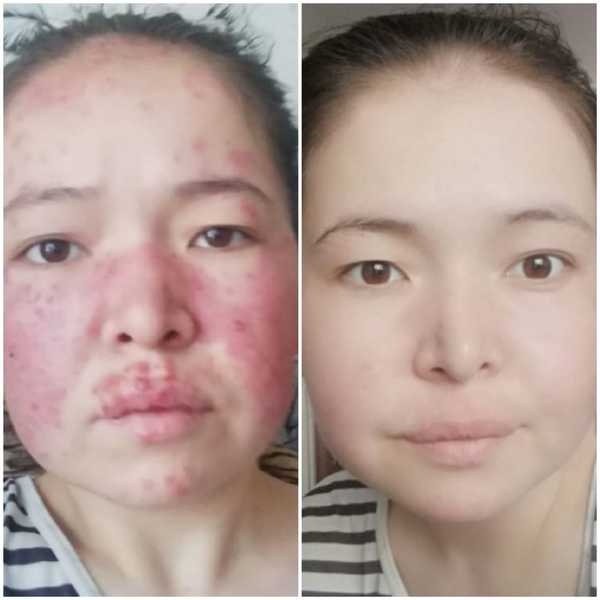 Японский оздоровительный комплекс - Изображение #3, Объявление #1663140