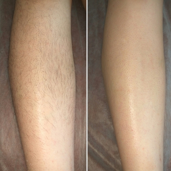 Шугаринг. Сахарная эпиляция. Персидская эпиляция - Изображение #2, Объявление #1684301