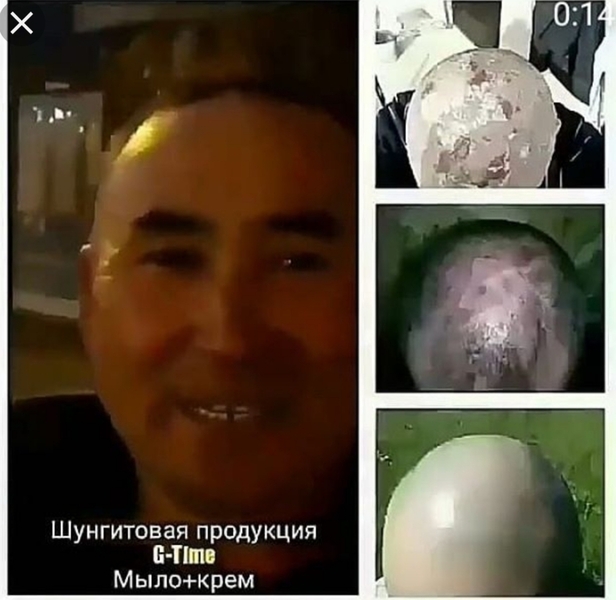 Продам шунгитовое лечебное мыло - Изображение #5, Объявление #1701106