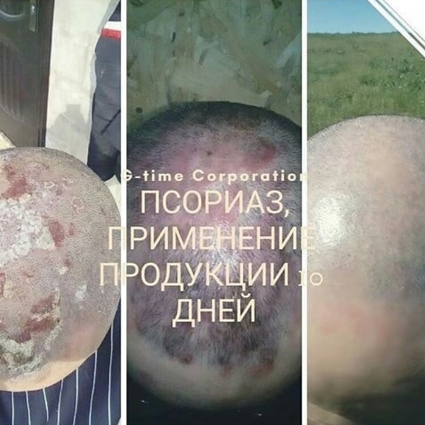 Шунгитовое мыло - Изображение #3, Объявление #1682616