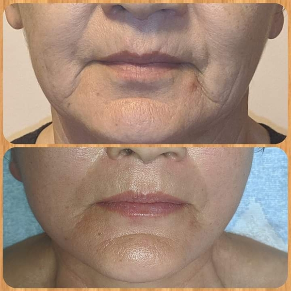 Профессиональный маccaж Aлматы - Изображение #3, Объявление #1742337