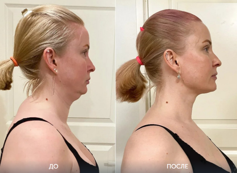 Продам натуральный нефритовый камень для омоложения лица - Изображение #5, Объявление #1742408