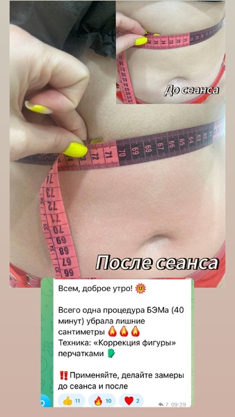 ОРГАНЫ ПОД ЗАЩИТОЙ БИОЭНЕРГИИ. - Изображение #4, Объявление #1751768