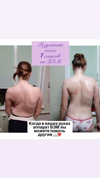 ОРГАНЫ ПОД ЗАЩИТОЙ БИОЭНЕРГИИ. - Изображение #6, Объявление #1751768